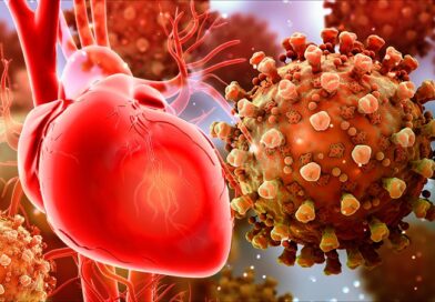 MALATTIE ISCHEMICHE DELCUORE NEI PERIODI PRE E POST PANDEMIA COVID-19