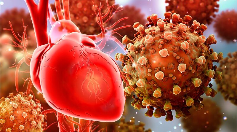 MALATTIE ISCHEMICHE DELCUORE NEI PERIODI PRE E POST PANDEMIA COVID-19